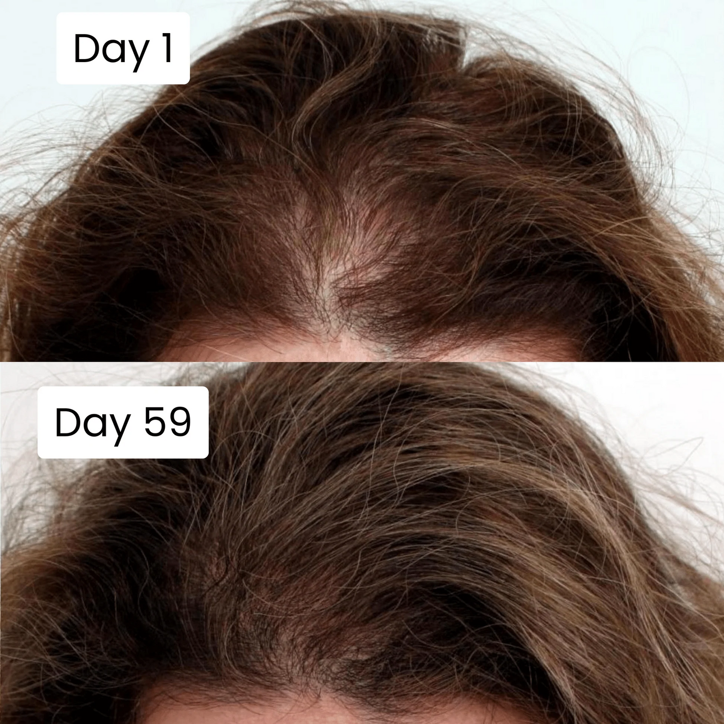 FolliCure Pro | 20ml