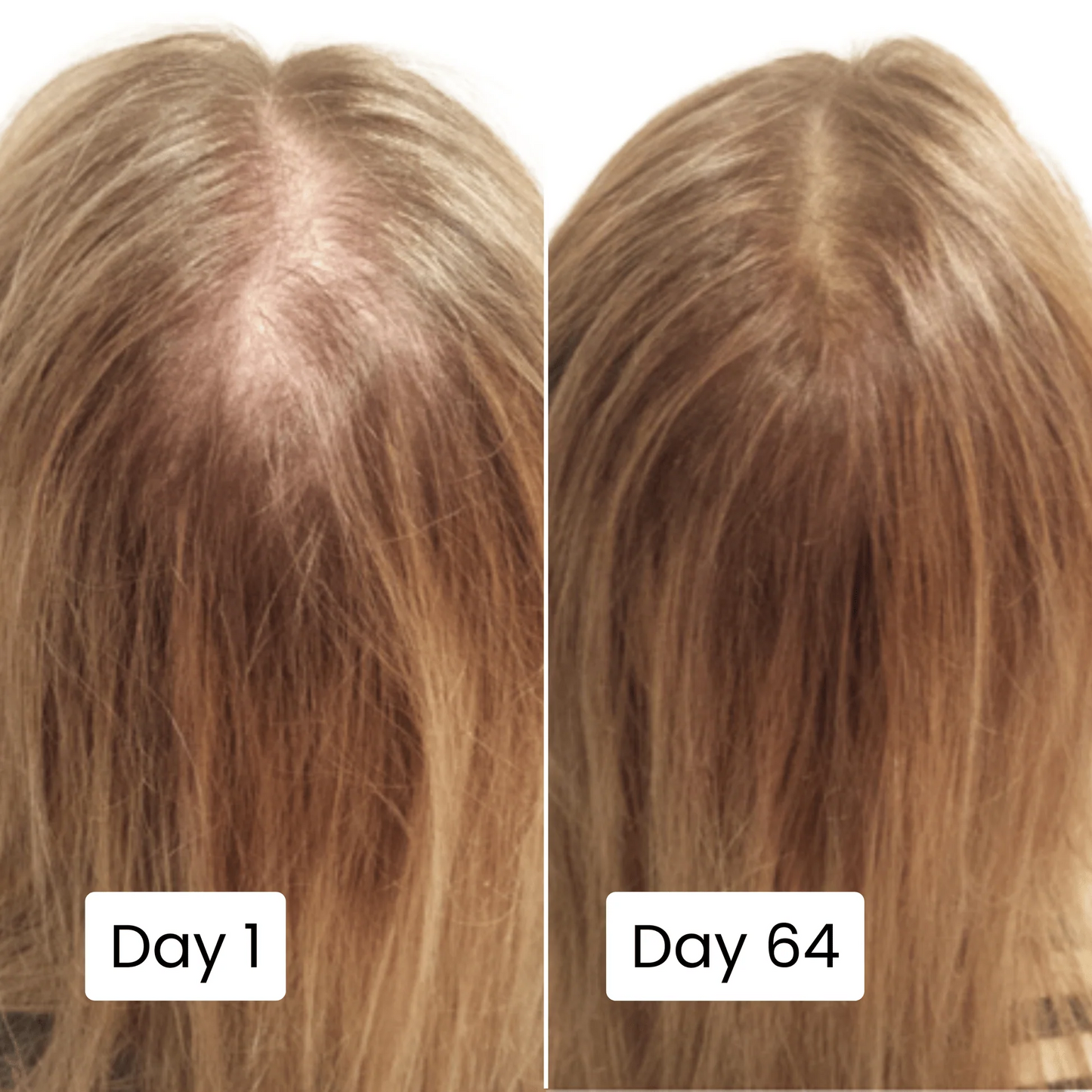 FolliCure Pro | 20ml