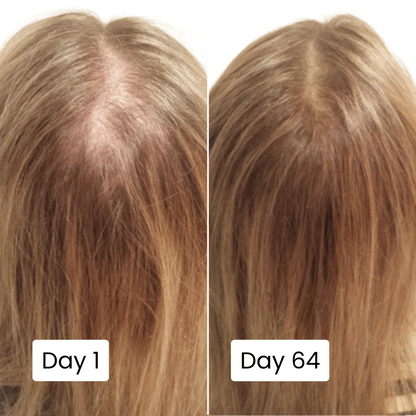FolliCure Pro | 20ml