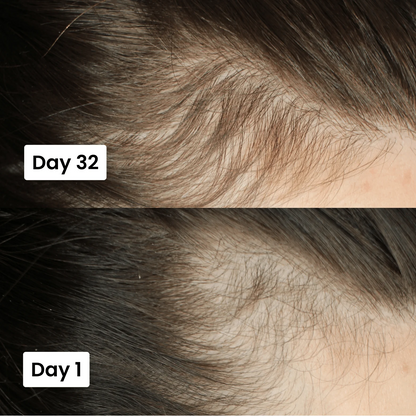 FolliCure Pro | 20ml